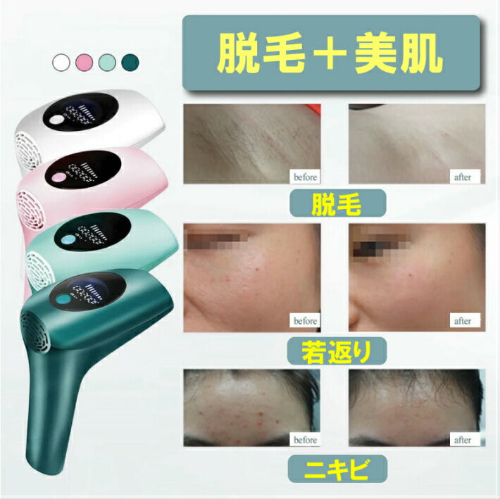 IPL 光 脱毛器 90万回 フラッシュ ライト交換不要 家庭用 脱毛機 美顔器 ヒゲ脱毛 レーザー 全身 脱毛 メンズ レディース ムダ毛 処理 デリケートゾーン アンダーヘア vioライン 顔 背中 ボディ フェイス ヒゲ ひげ 髭 脇 腕 指 ワキ ウデ 顔 自動照射 人気